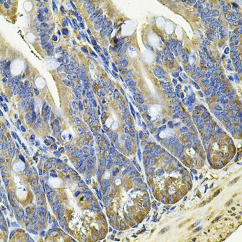 Immunohistochemistry - EIF3C Polyclonal Antibody (144-07022)