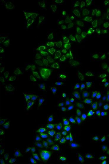 Immunofluorescence - TRAF3 Polyclonal Antibody (144-03094)