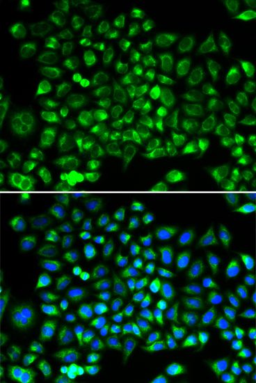 Immunohistochemistry - DNM1L Polyclonal Antibody (144-02586)