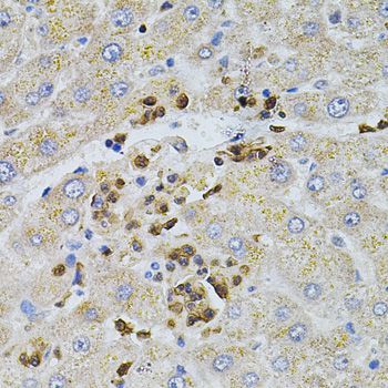 Immunohistochemistry - BEST1 antibody (144-03022)