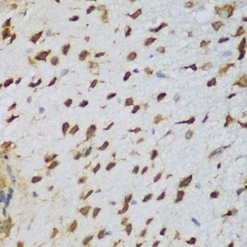 Immunohistochemistry - NCL Polyclonal Antibody (144-05904)