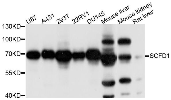 Western blot - SCFD1 antibody (144-08835)