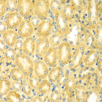 Immunohistochemistry - PDE4DIP antibody (144-07765)