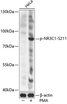 Western blot