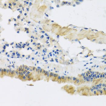 Immunohistochemistry - CLIP1 antibody (144-07722)