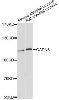 Western blot - CAPN3 Antibody (144-11995)