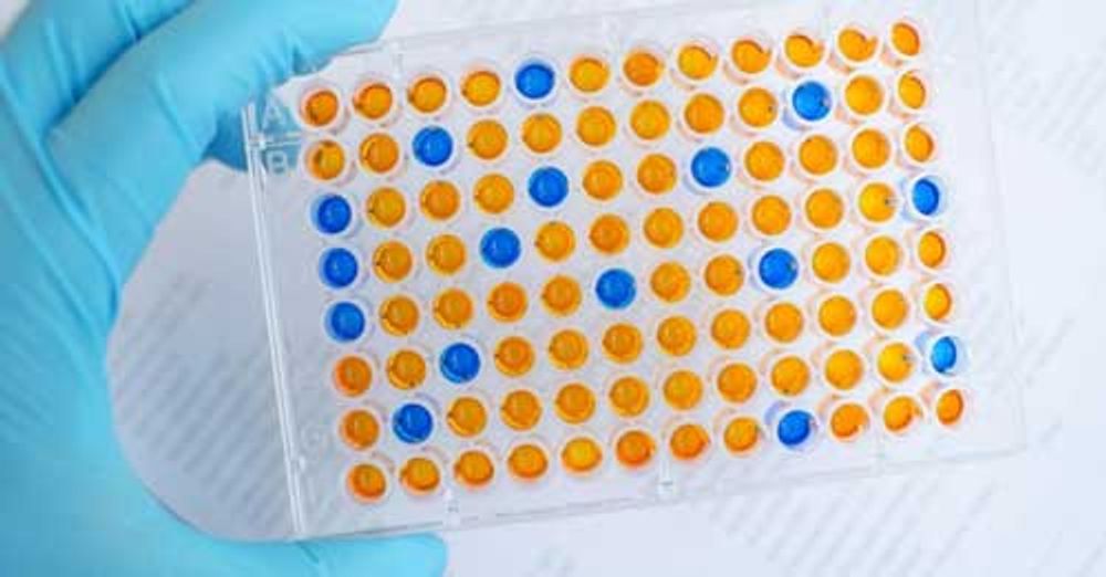 ELISA 96-well plate