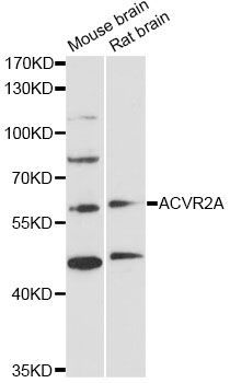 Western blot - ACVR2A Polyclonal Antibody (144-01981)