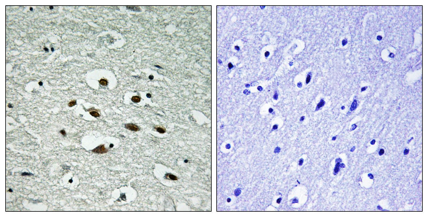 IHC