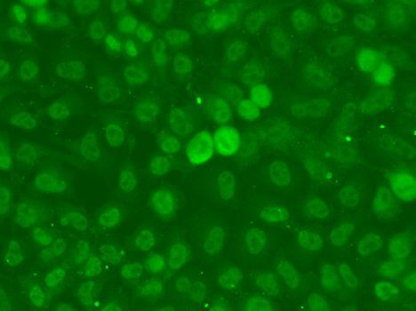 Immunofluorescence - SSNA1 antibody (144-013377)