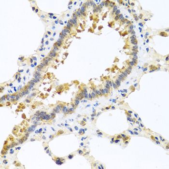 Immunohistochemistry - CPA1 antibody (144-03803)