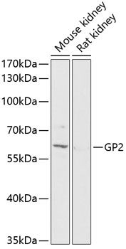 Western blot