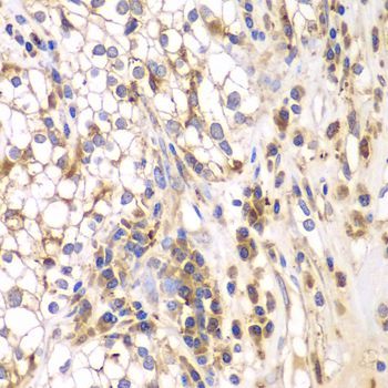 Immunohistochemistry - SRPK1 antibody (144-05854)