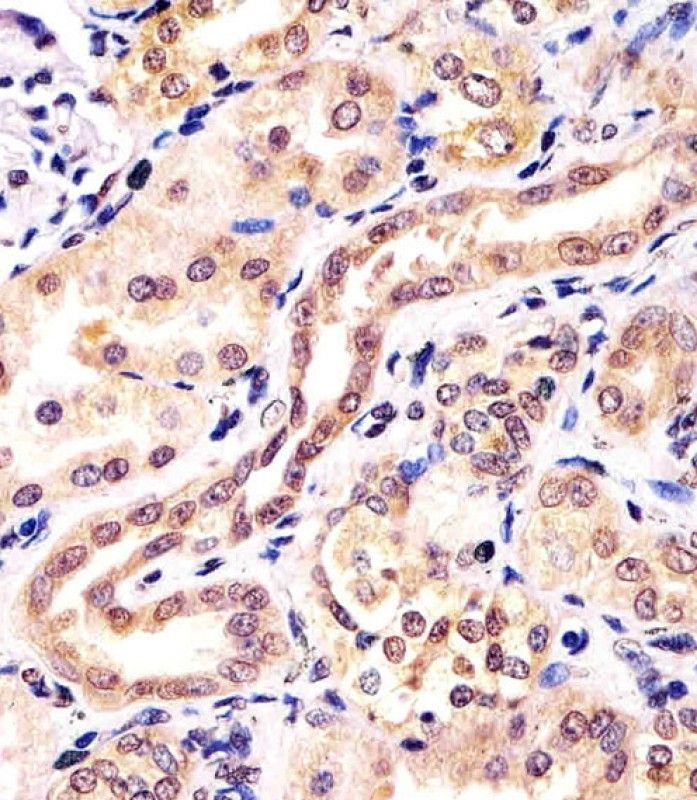 IHC-P