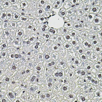 Immunohistochemistry - SMN2 Polyclonal Antibody (144-01652)