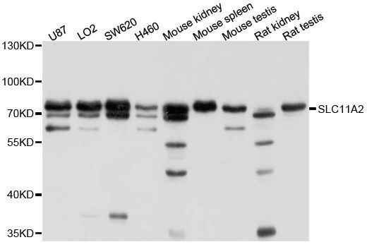 Western blot - SLC11A2 Polyclonal Antibody (144-010231)
