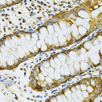 Immunohistochemistry - HSP90AB1 Antibody (144-01087)