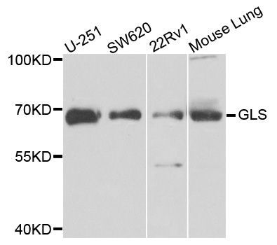 Western blot - GLS Polyclonal Antibody (144-03885)