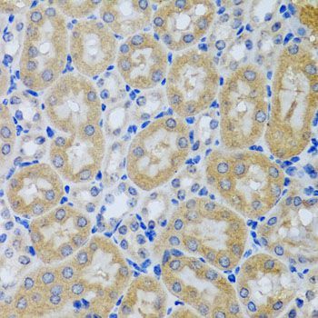 Immunohistochemistry - ACP1 antibody (144-012390)