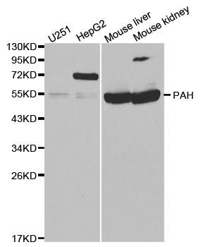 Western blot - PAH Polyclonal Antibody (144-01559)