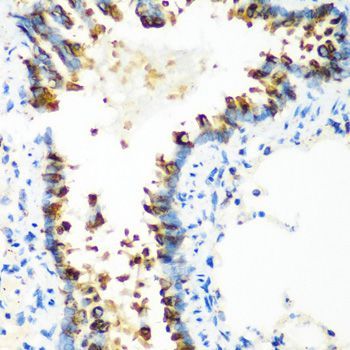 Immunohistochemistry - MT-CO2 antibody (144-011522)
