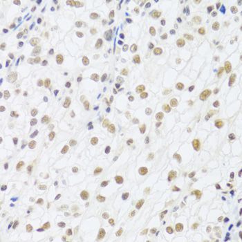Immunohistochemistry - DDB1 Polyclonal Antibody (144-02896)