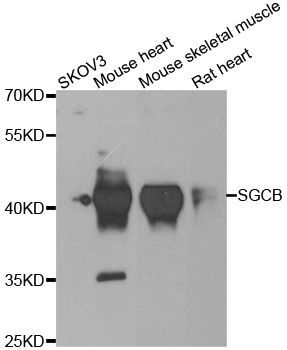 Western blot - SGCB antibody (144-06979)