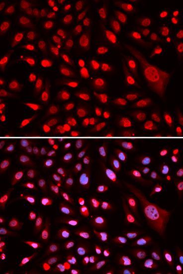 Immunofluorescence - CBFB antibody (144-05305)
