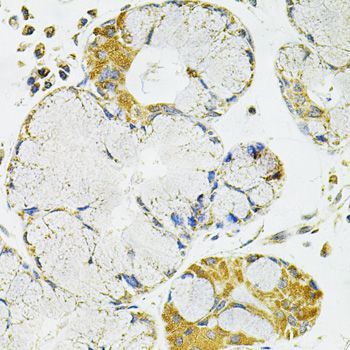 Immunohistochemistry - PPP1CA Polyclonal Antibody (144-12468)