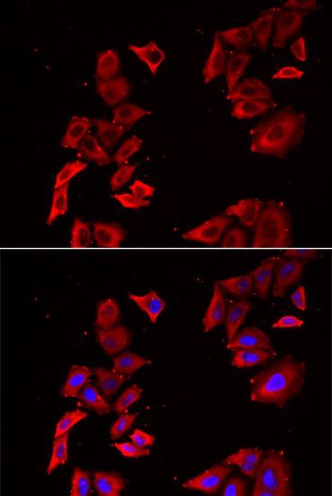 Immunofluorescence - MAP2K5 Polyclonal Antibody (144-06953)