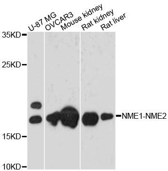 Western blot - NME1-NME2 antibody (144-60214)