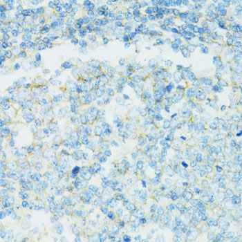 Immunohistochemistry - CD19 antibody (144-02577)