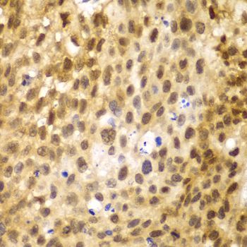 Western blot - [KO Validated] IRF3 Polyclonal Antibody (144-11118)