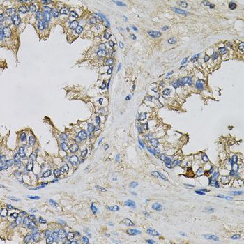Immunohistochemistry - EIF3H Polyclonal Antibody (144-013378)
