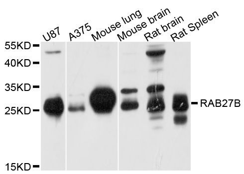 Western blot - RAB27B Polyclonal Antibody (144-600549)
