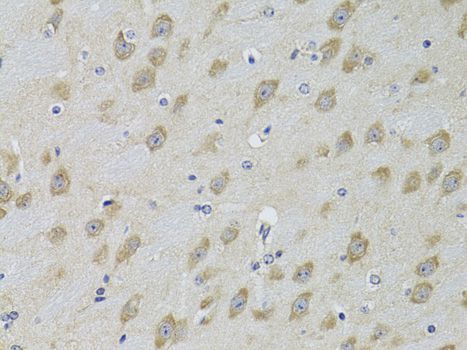 Immunohistochemistry - ADRBK2 Antibody (144-02049)