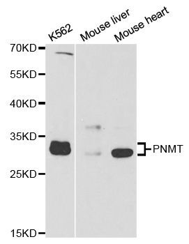 Western blot - PNMT antibody (144-05553)