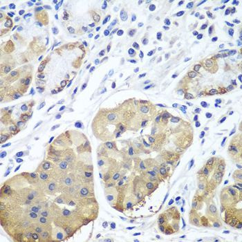 Immunohistochemistry - PLCB2 antibody (144-08141)