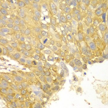 Immunohistochemistry - ACTN1 antibody (144-01160)