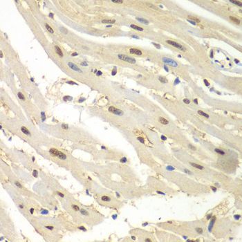 Immunohistochemistry - HDAC2 Polyclonal Antibody (144-02084)