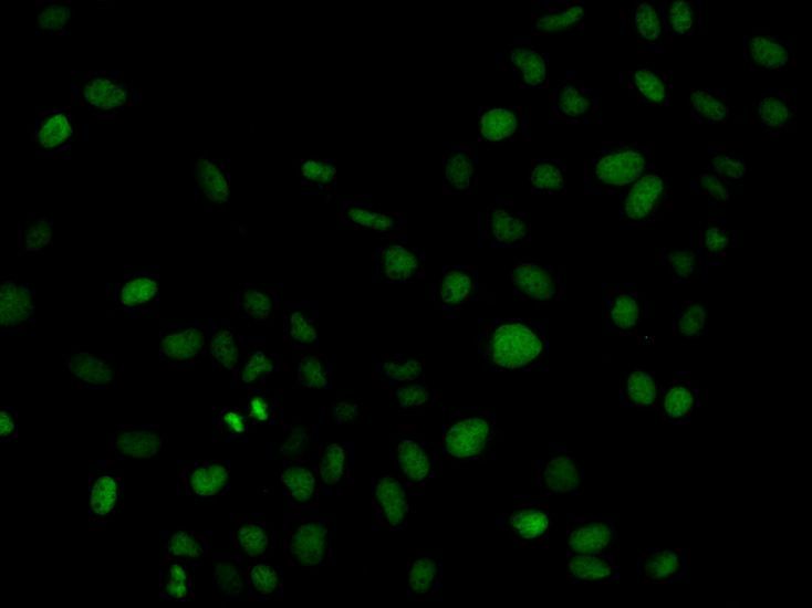 Immunofluorescence - PLCG2 Polyclonal Antibody (144-02182)