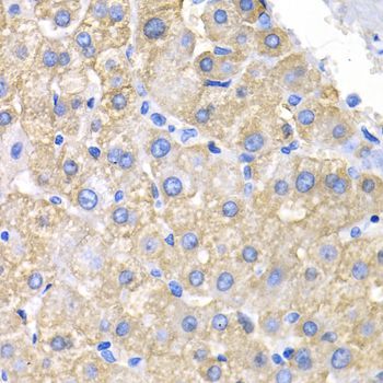 Immunohistochemistry - CRK antibody (144-01604)