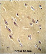 IHC-P