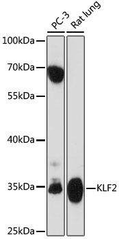 Western blot
