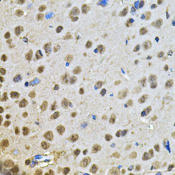 Immunohistochemistry - PPID Polyclonal Antibody (144-06949)