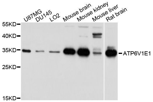 Western blot - ATP6V1E1 Polyclonal Antibody (144-03756)