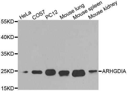 Western blot - [KO Validated] ARHGDIA Polyclonal Antibody (144-01214)