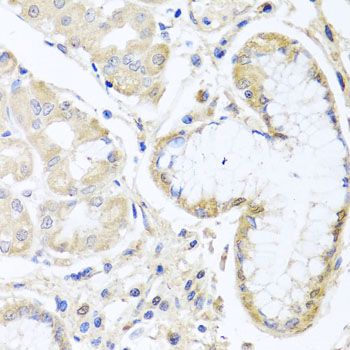 Immunohistochemistry - INPP5K antibody (144-07807)