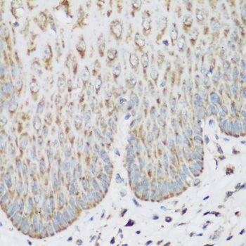 Immunohistochemistry - IGF2BP3 Polyclonal Antibody (144-04444)