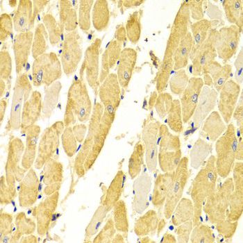 Immunohistochemistry - CA3 Antibody (144-01212)